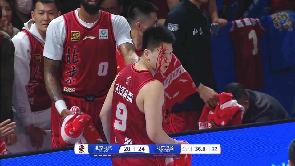 DB电子官网太硬了！雷蒙眼角缝完10针后今天正常训练